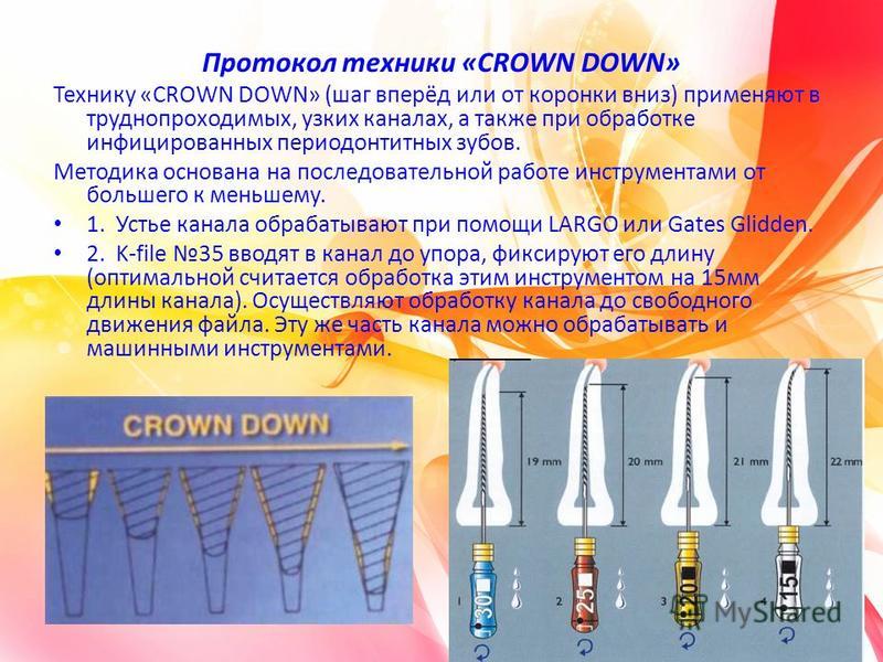 Техника расширения. Crown down расширения корневого канала. Техника Crown down в стоматологии этапы. Краун даун техника эндодонтия. Crown down техника в эндодонтии.