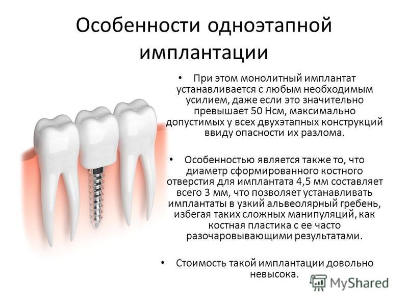 Зубы импланты поэтапно. Двухэтапная методика имплантации. Методики дентальной имплантации. Имплант зуба схема установки. Одноэтапный протокол: имплантация.