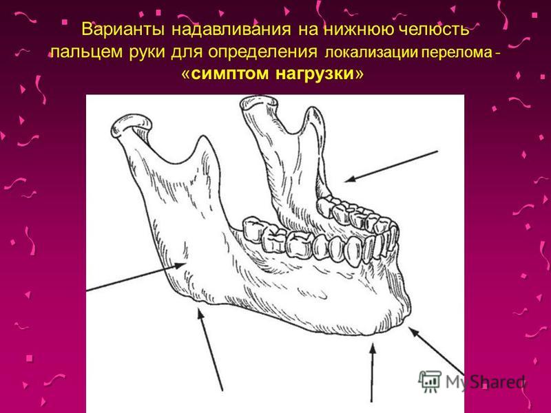 Сводит челюсть