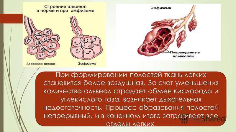 Дополнительные функции альвеол