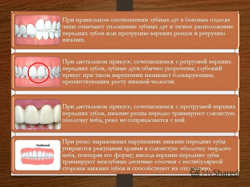 Какой должен быть правильный прикус у человека. Соотношение зубов. Какой должен быть правильный прикус. Тесное расположение зубов. Форма зубной дуги.