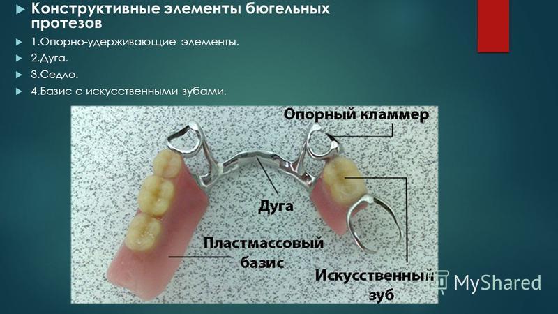 Бюгельный протез на ночь снимать. Бюгельные протезы конструкционные элементы.