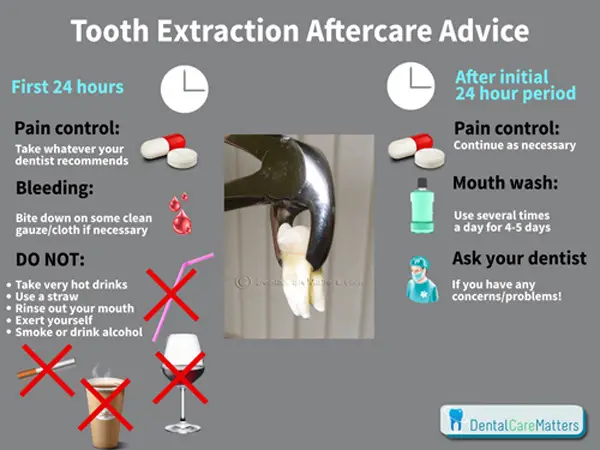 What to do After Tooth Extraction Pain relief