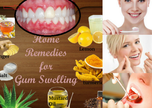 Treatments For Gums Inflammation