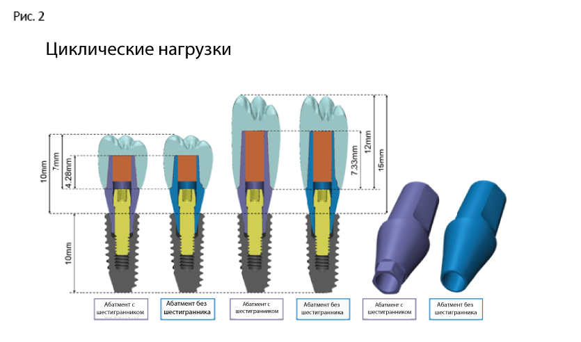 Абатмент что это такое фото