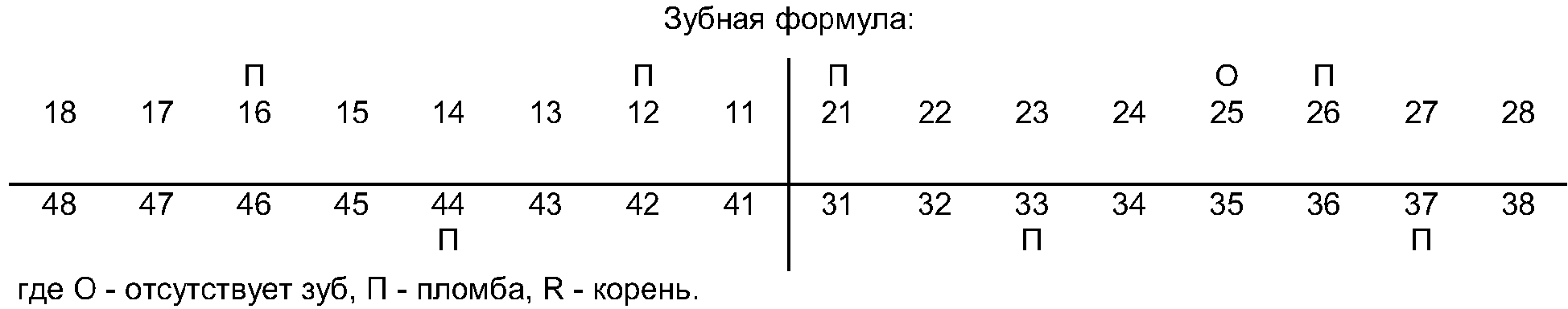 Зубная формула отзывы. Зубная формула обозначения. Зубная формула в стоматологии пример. Зубная формула с пломбами. Зубная формула кариес пломба.