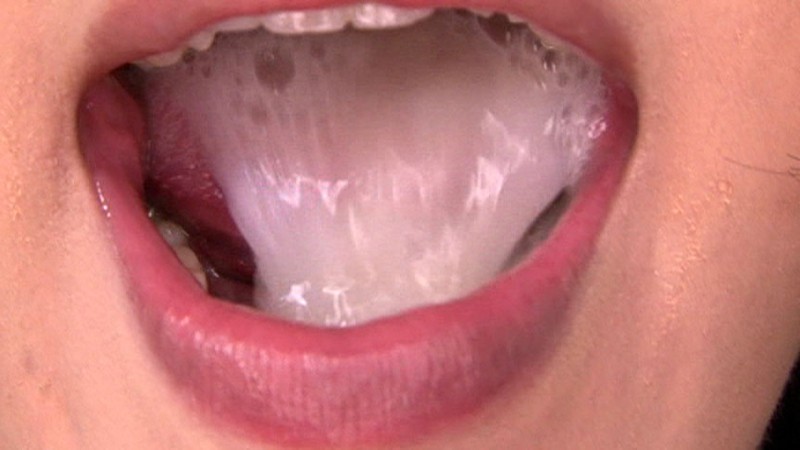 Уздечка языка - это складка слизистой оболочки полости рта