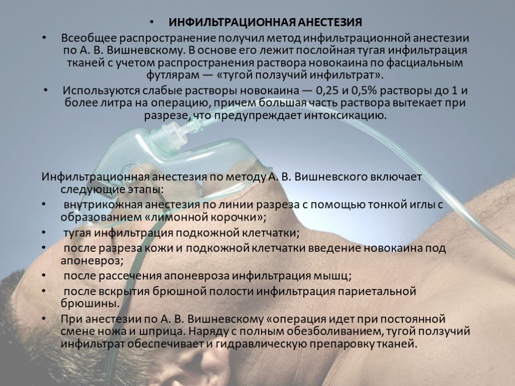 После общего. Новокаин для инфильтрационной анестезии. Инфильтрационная анестезия классификация. Методика инфильтрации анестезии. Инфильтрационная анестезия по Вишневскому.