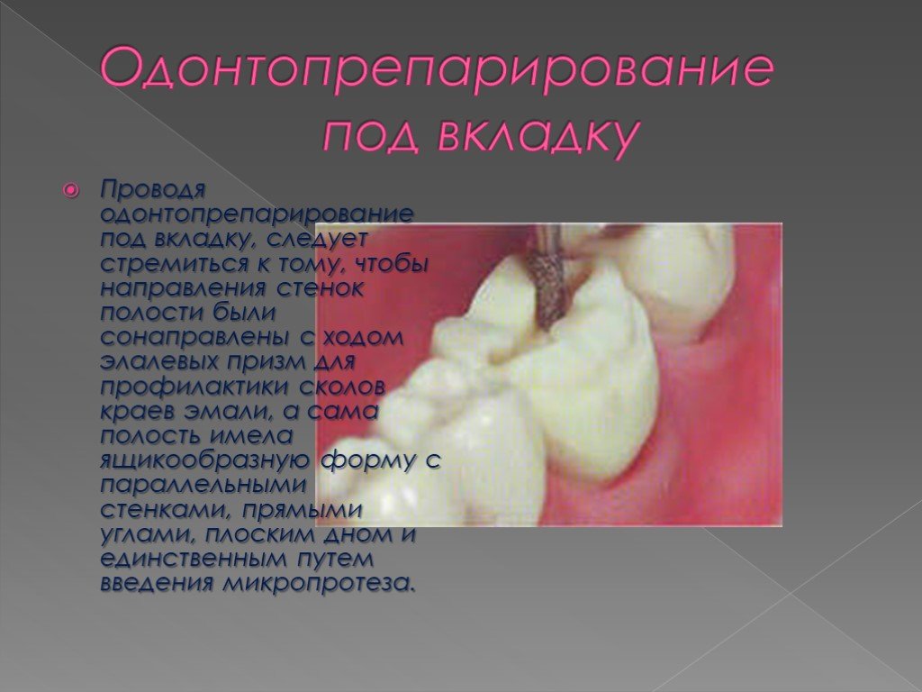 Препарирование зуба. Одонтопрепарирование под вкладку. Одонто припарирование. Зубные вкладки презентация.