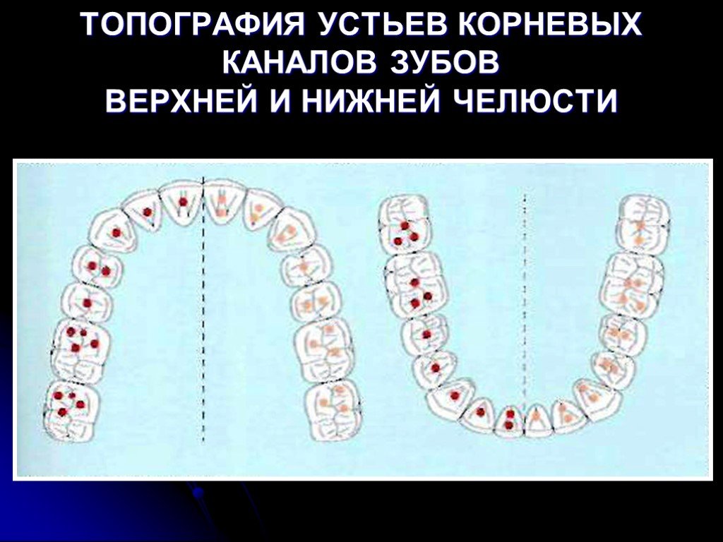 Корни зубов верхней челюсти схема