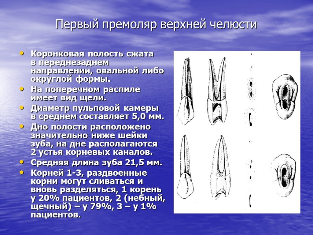 Верхний 5 зуб канал