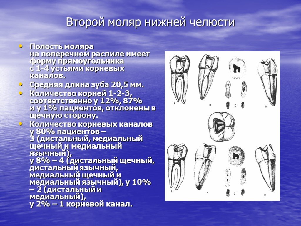 Второй верхний коренной зуб. Второй моляр нижней челюсти анатомия корневых каналов. Второй моляр нижней челюсти эндодонтия. Форма полости моляров нижней челюсти:. 1 Моляр нижней челюсти анатомия корневых каналов.