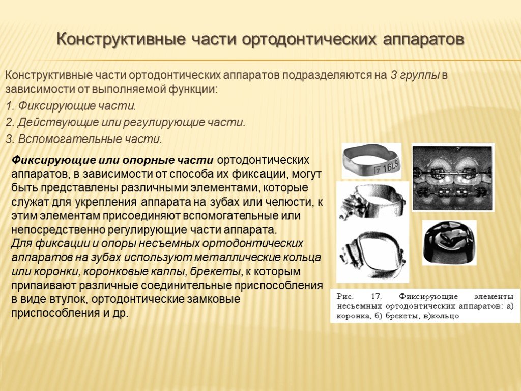 Вид аппарата. Элементы съемных ортодонтических аппаратов. Классификация съемных ортодонтических аппаратов. Механические аппараты принципы действия в ортодонтии. Классификация механических аппаратов ортодонтия.