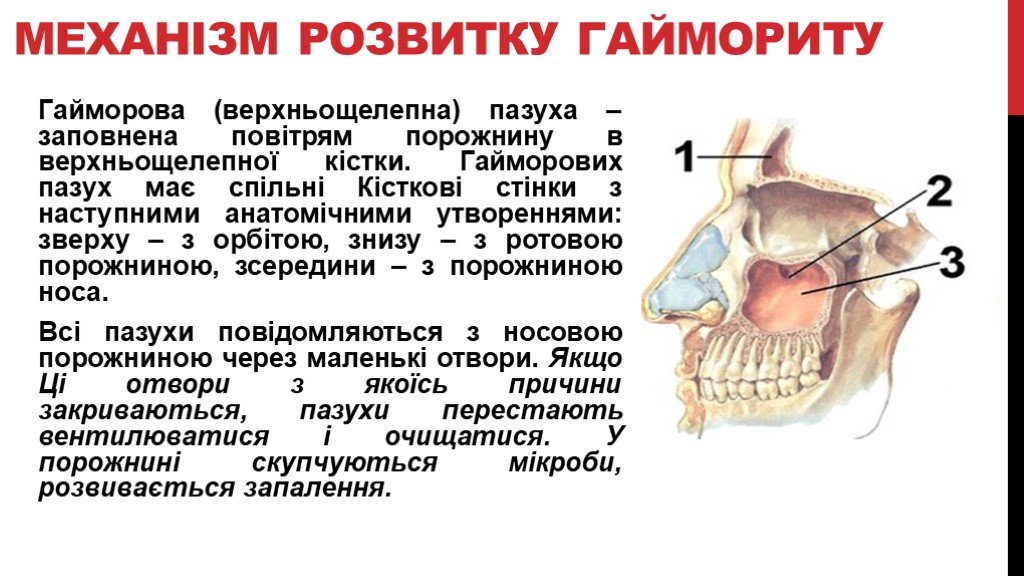 Зубы и пазухи гайморовы расположение схема