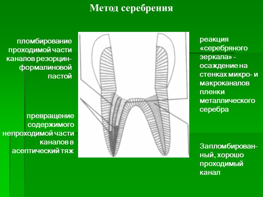 Канал метода. Резорцин формалиновый. Метод серебрения пломбирования корневого канала. Метод серебрения зубов. Импрегнация корневых каналов.