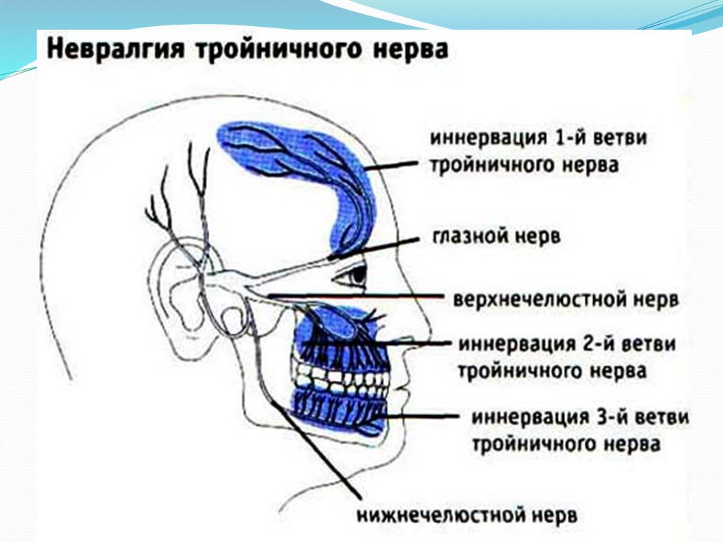 Троичный лицевой нерв воспаление. Невралгия 3 ветви тройничного нерва. 1 И 2 ветвь тройничного нерва. Невралгия второй ветви тройничного нерва. Невралгия первой ветви тройничного нерва симптомы.