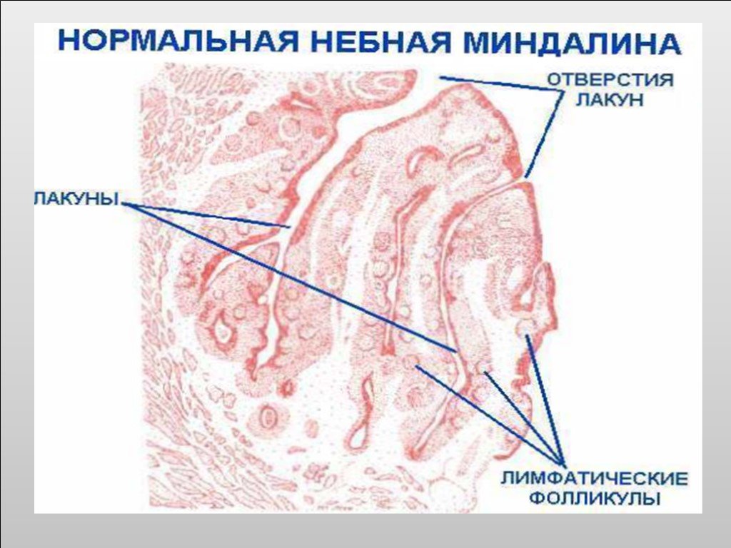 Миндалина гистология рисунок