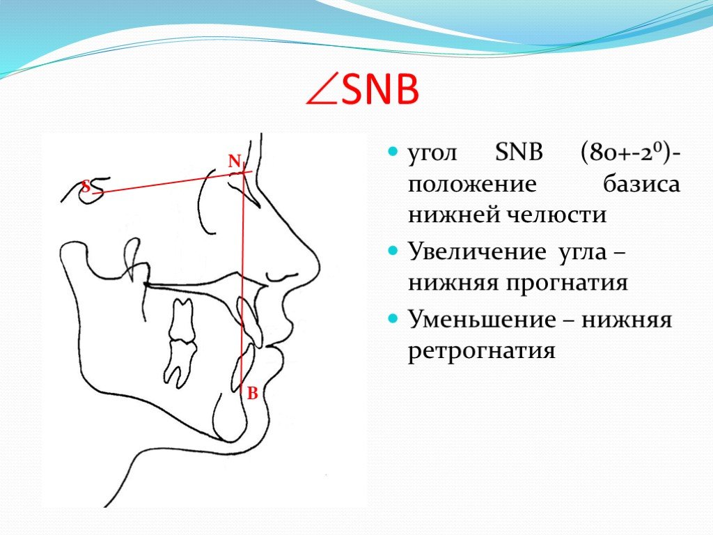 Угол spp mp. Угол sna на ТРГ. Угол sna в ортодонтии. Угол SNB на ТРГ. Угол SPP NSL ортодонтия.