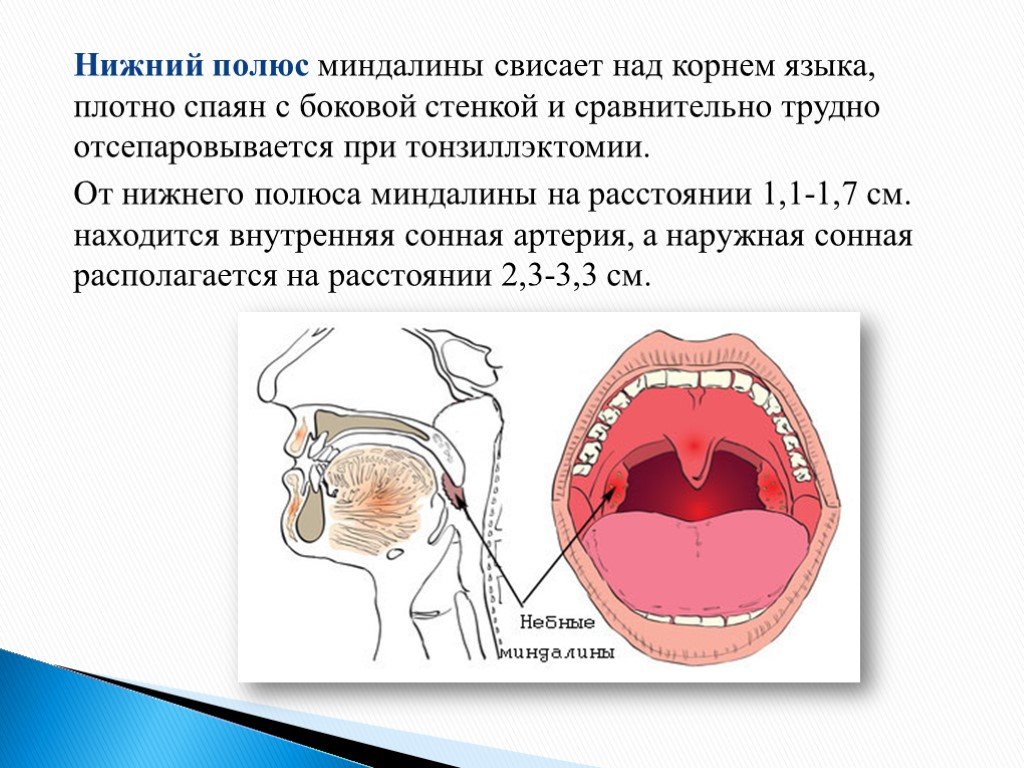 Где находятся гланды у человека показать на рисунке