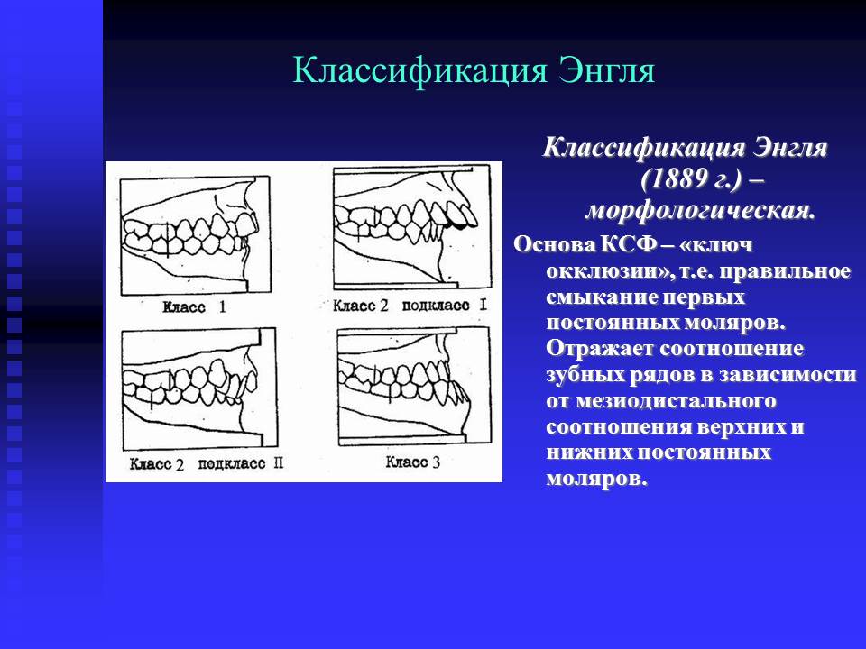 Окклюзия это. Классификация аномалий Энгля. Скелетные классы по Энглю. Классификация аномалий прикуса по Энглю. Классификация аномалий зубов, зубных рядов и прикуса Энгля.