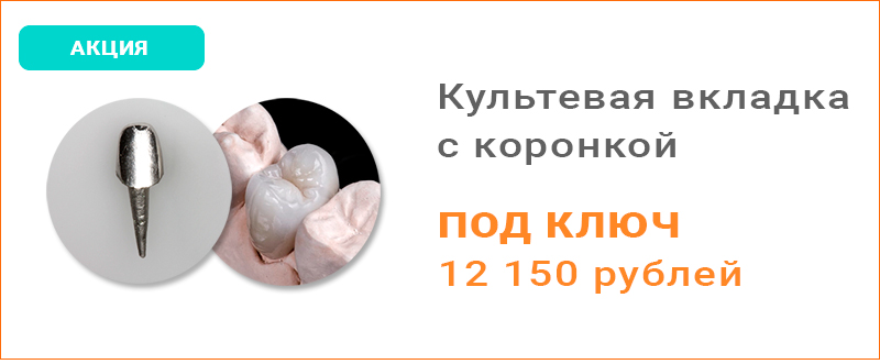 Культевая вкладка и коронка схема