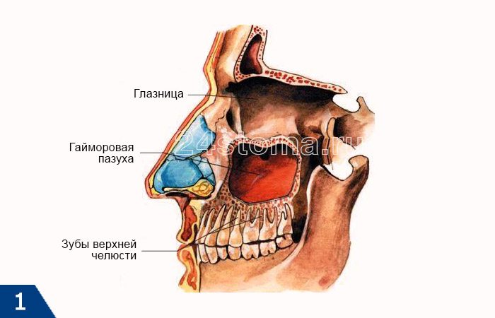 Правая верхнечелюстная пазуха. Гайморова пазуха верхней челюсти. Гайморовы пазухи расположение. Гайморова пазуха верхней челюсти сообщается. Гайморова пазуха расположена верхняя челюсть.