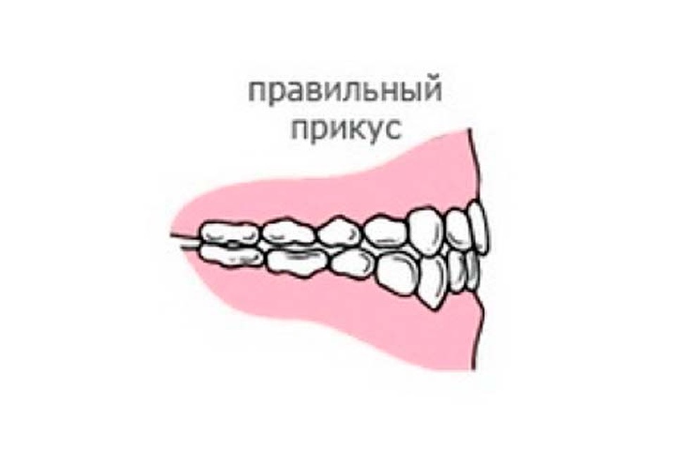 Правильный прикус у человека схема как определить