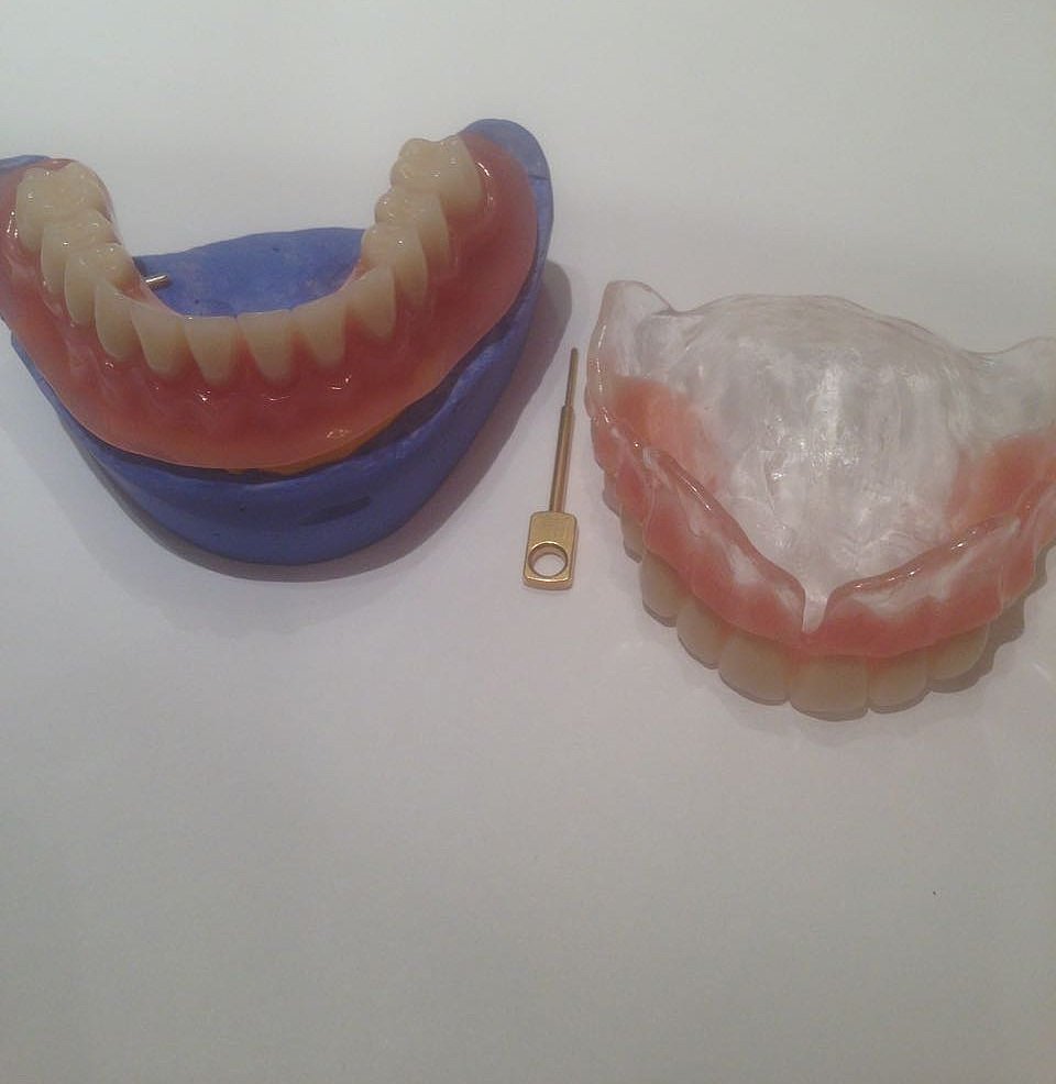 Какие зубные протезы лучше при отсутствии зубов. Полносъемные протезы ортопедическая стоматология. Протез Денталур полиуретановый протез. Полносъемный протез нижней челюсти. Акриловый протез полносъемный на 2 замках полносъемный.