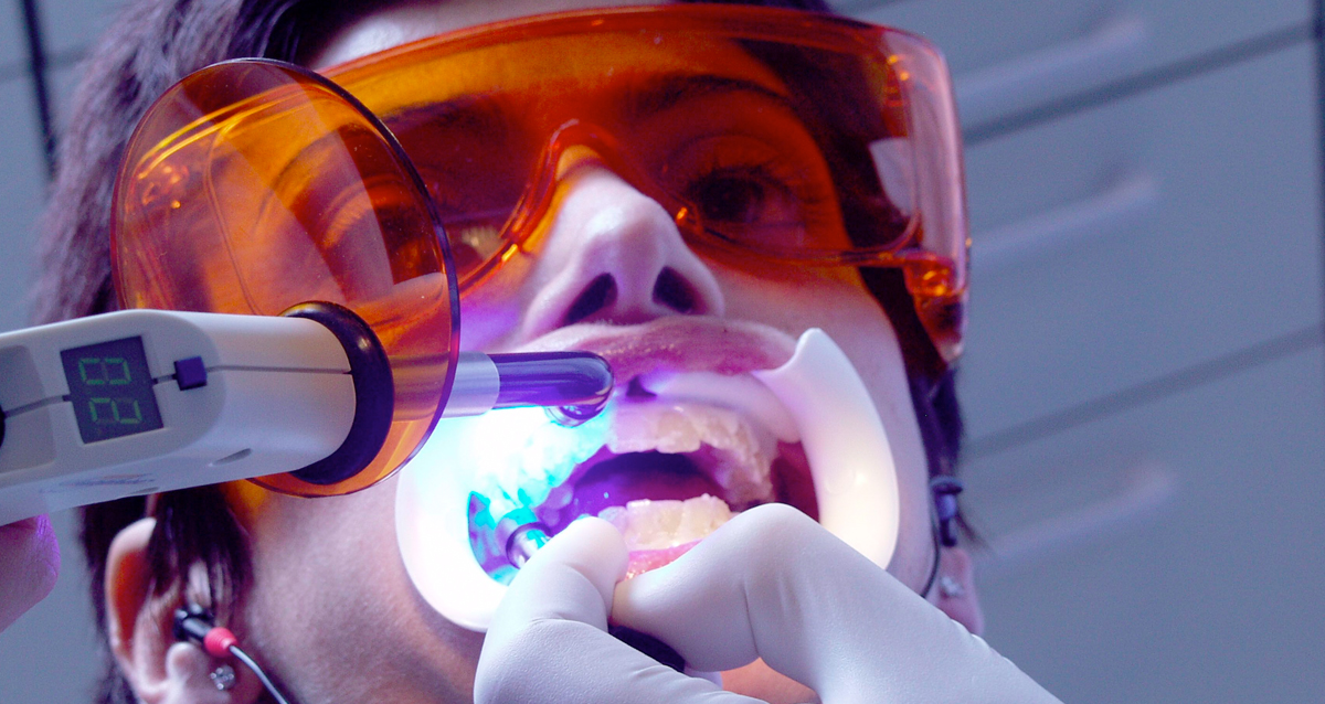 Лазерное десен. Стоматологический лазер. Лазерное отбеливание зубов. Лазерные технологии в стоматологии.