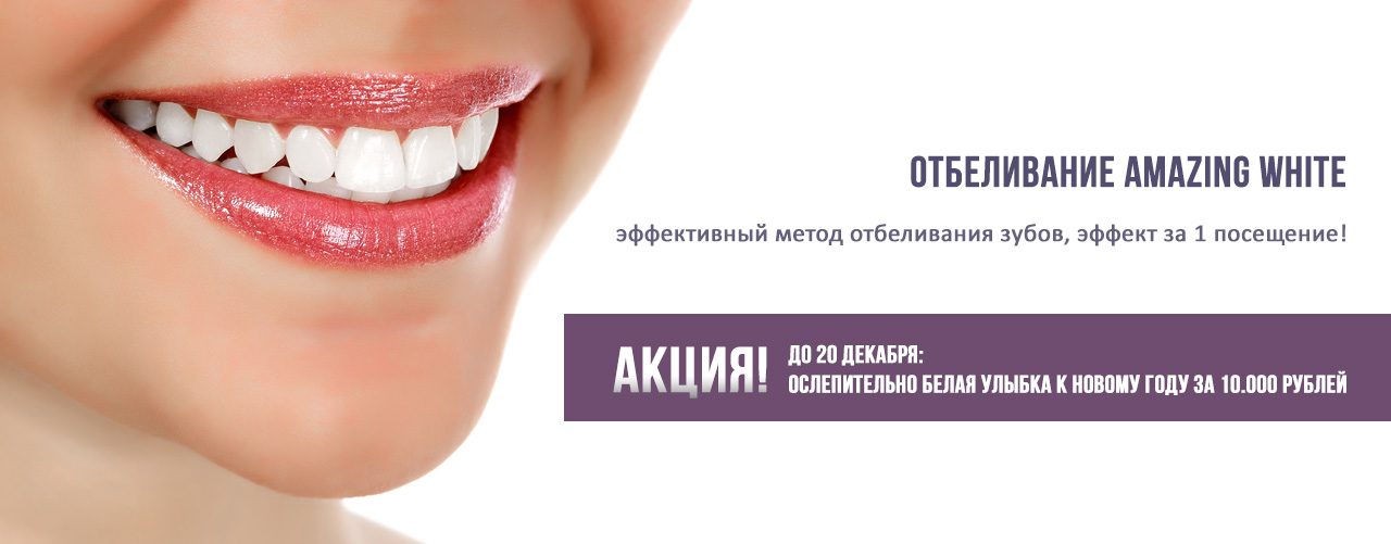 Amazing white отбеливание. Amazing White реклама. Отбеливание зубов amazing White сертификат. Отбеливание амазинг Вайт реклама. Клинья в стоматологии.