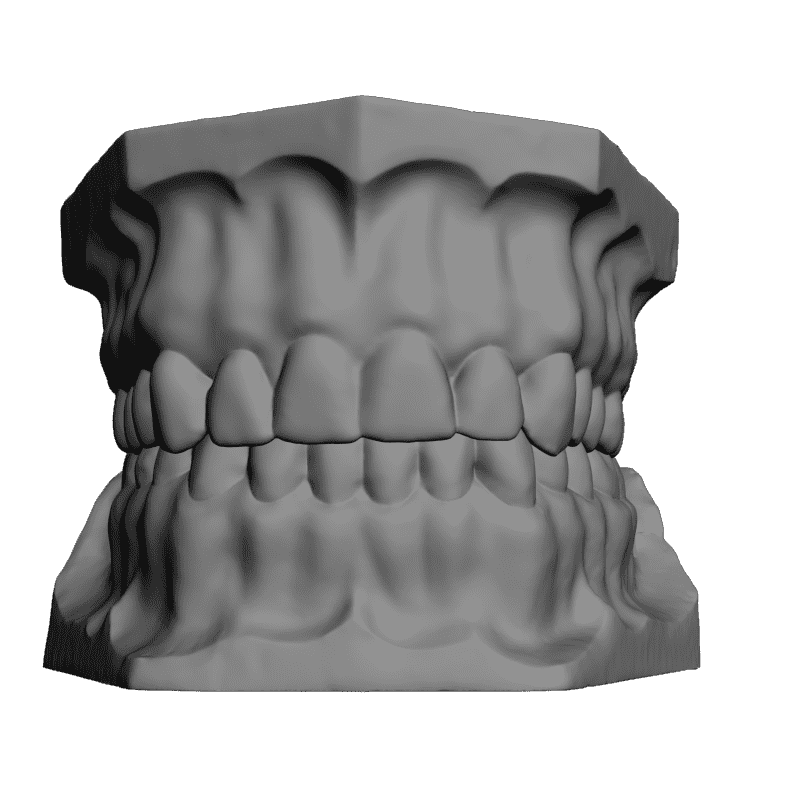 3д модель зуба. Rectangular Octagonal 4 Prong Ring casting STL 3d. Зубы l5 l3. STL модель зуба. 3d моделирование зубов.