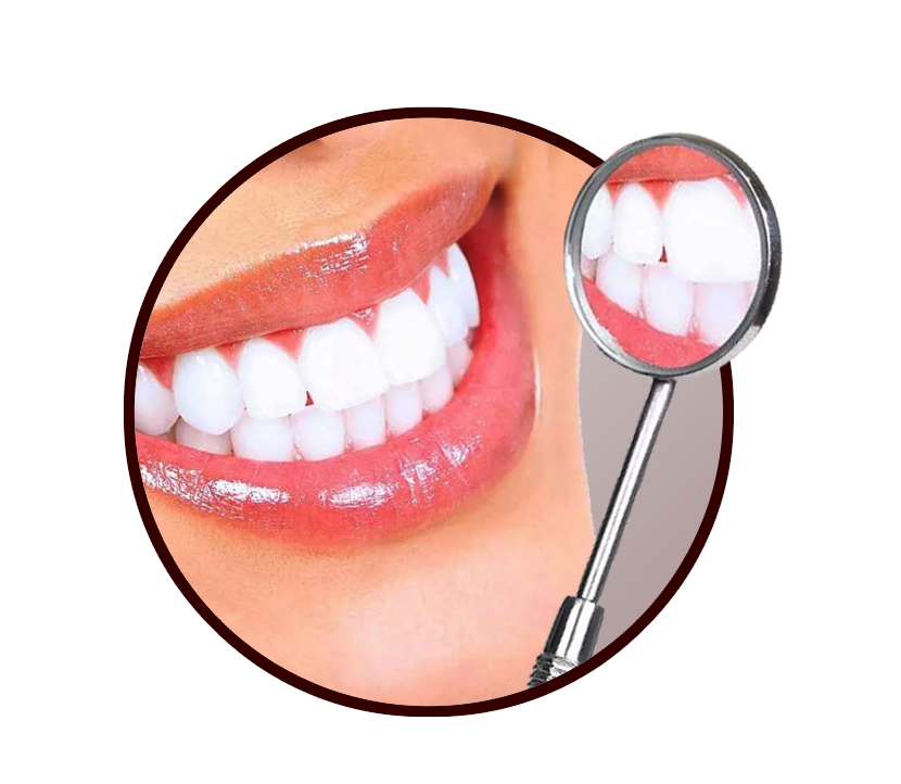 Методы отбеливания зубов. Отбеливание зубов. Отбеливание зубов улыбка. Отбеливание зубов изнутри. Косметическое отбеливание зубов.