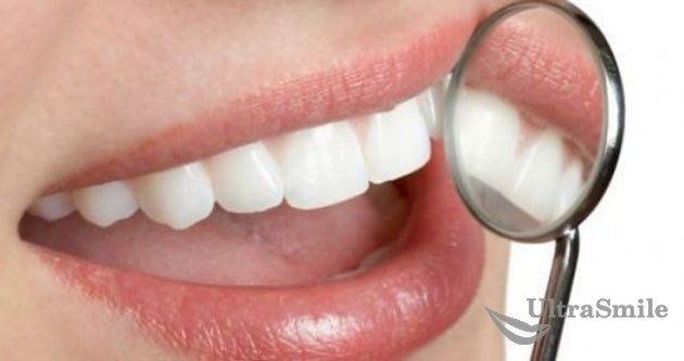 отбеливание-зубов-перекисью-водорода
