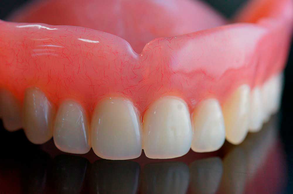 Съемный зубной протез акри фри фото