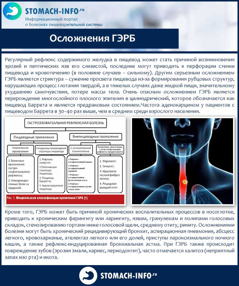 Диета и меню при рефлюкс эзофагите