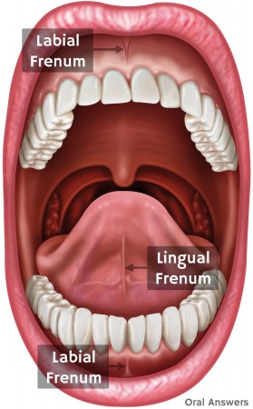 Lingual Frenum and Labial Frenum