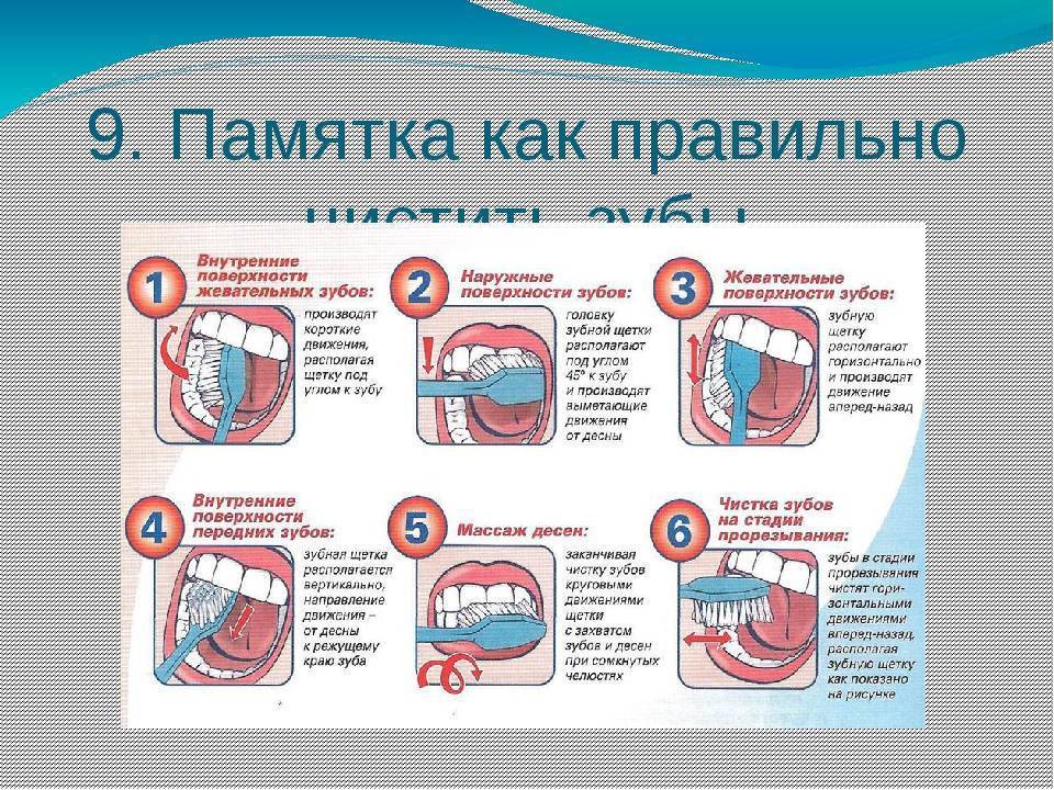 Видео как правильно чистить. Как правильно чистить зубы. Правильная чистка зубов. Памятка чистки зубов. Памятка как правильно чистить зубы.