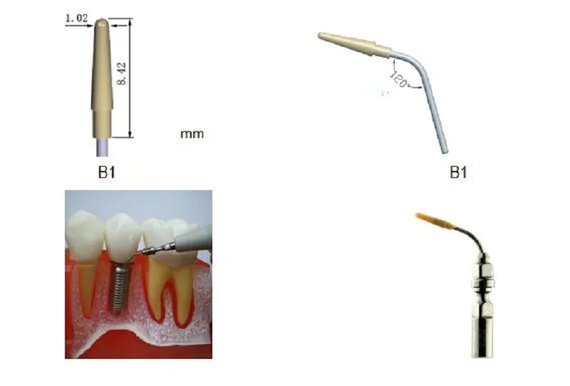 Как называется инструмент для чистки зубов ультразвуком. Инструмент для снятия зубных отложений(скалер) 922. Скалер для снятия зубных отложений s 204s.
