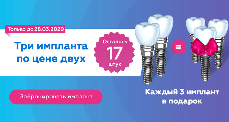 Сколько лет стоят импланты. Имплант Лаб. Расценки на имплантация зубов. Самый дешёвый имплант зуба.