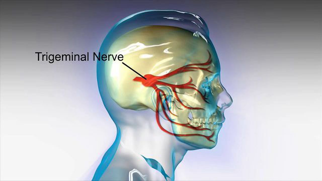 Нейропатия ветвей тройничного нерва. Neuralgia тройничный нерв. Троичный нерв воспален. Нерв на лице. Невралгия тройничного нерва физиотерапия.