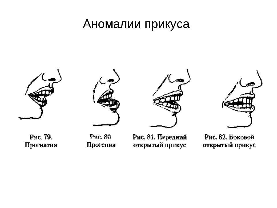 Правильный прикус у человека схема как определить фото