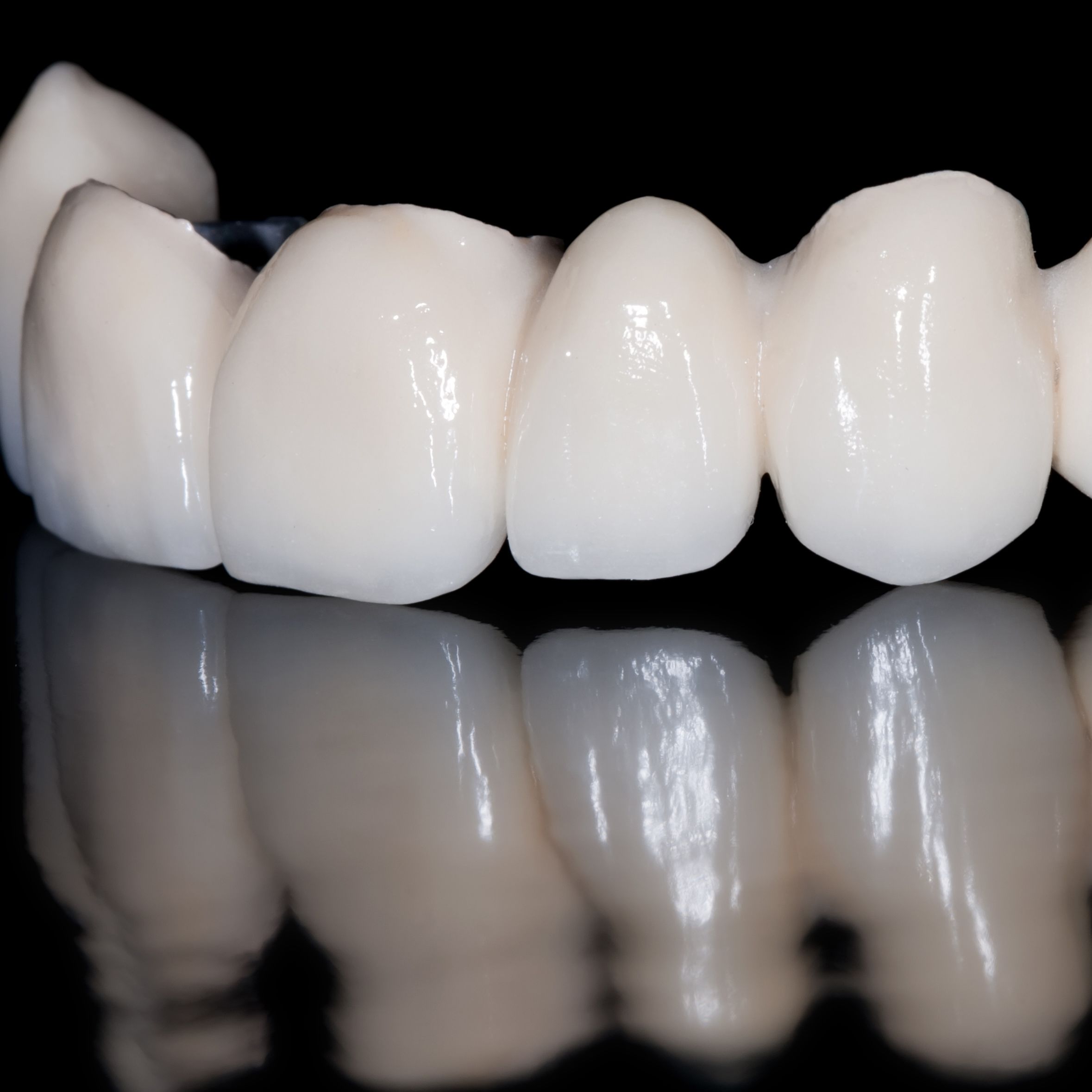 Коронки на зубы металлокерамика фото