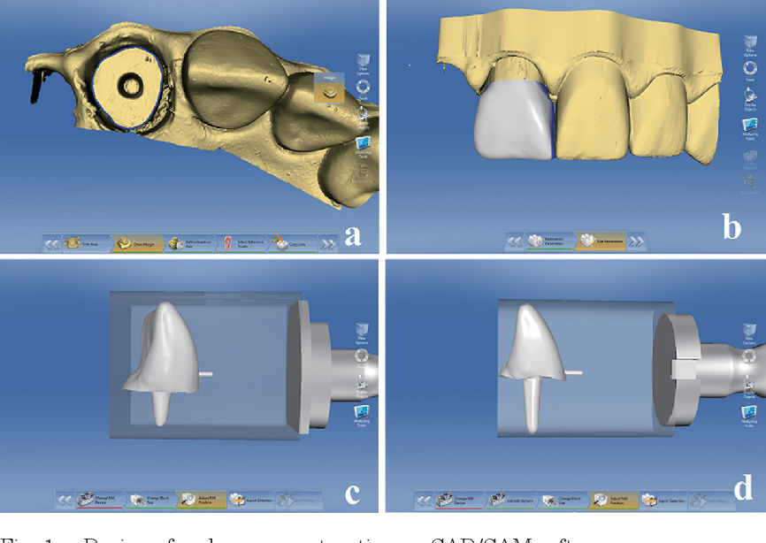 Сама технология. Программное обеспечение CAD cam хирургический модуль. Каппа сплинт CAD cam. CAD cam системы в ортодонтии. Моделирование в CAD/cam системах.