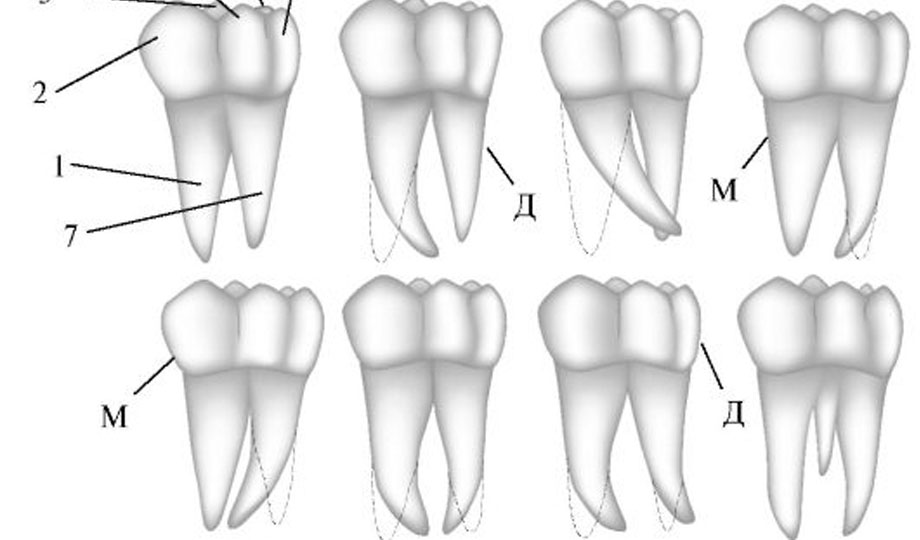 Как называются корни зубов. Третий моляр нижней челюсти. Корни у молочных зубов моляр. Корни Нижнего первого моляра.
