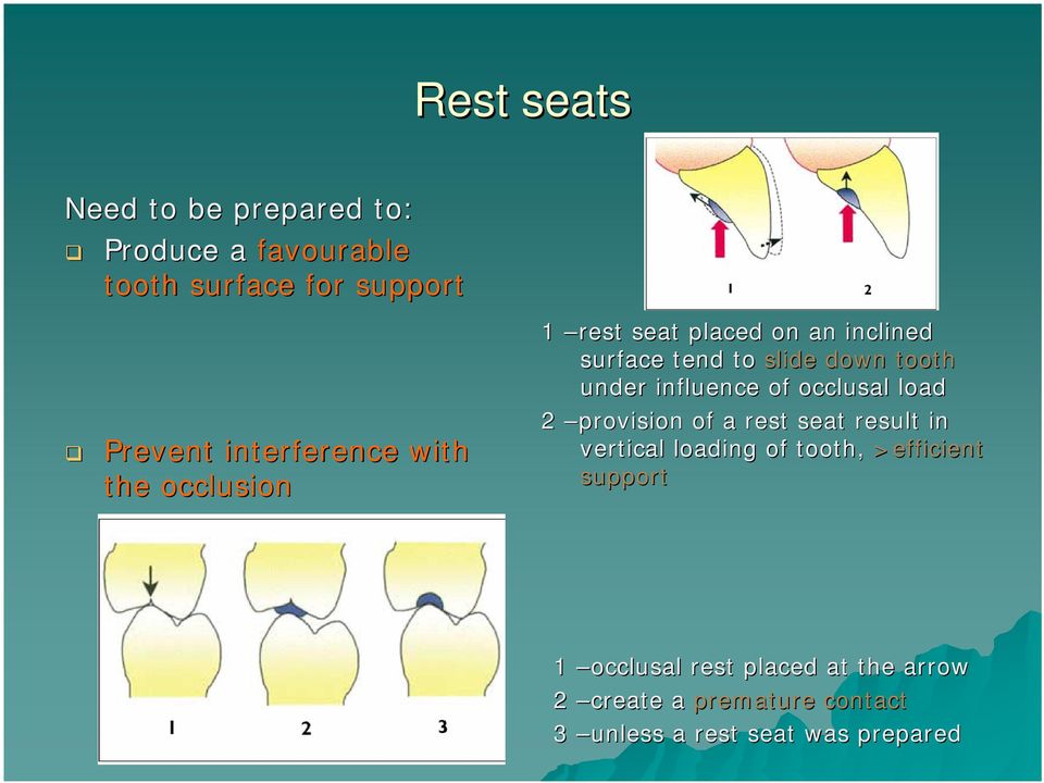 under influence of occlusal load 2 provision of a rest seat result in vertical loading of tooth,