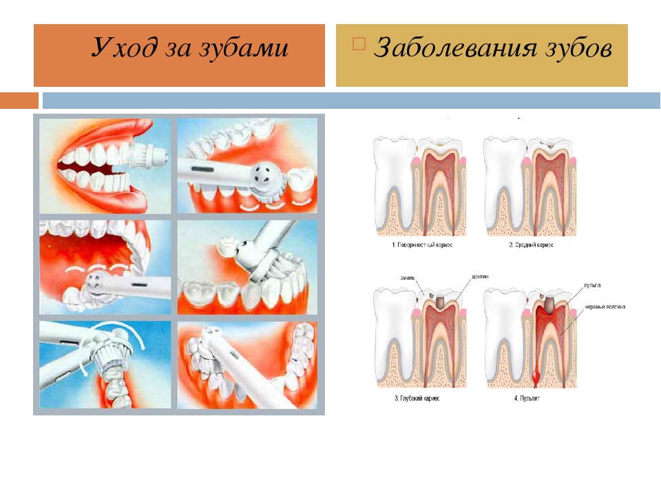 Классификация поражений зубов. Стоматологические заболевания зубов. Перечислить заболевание зубов.