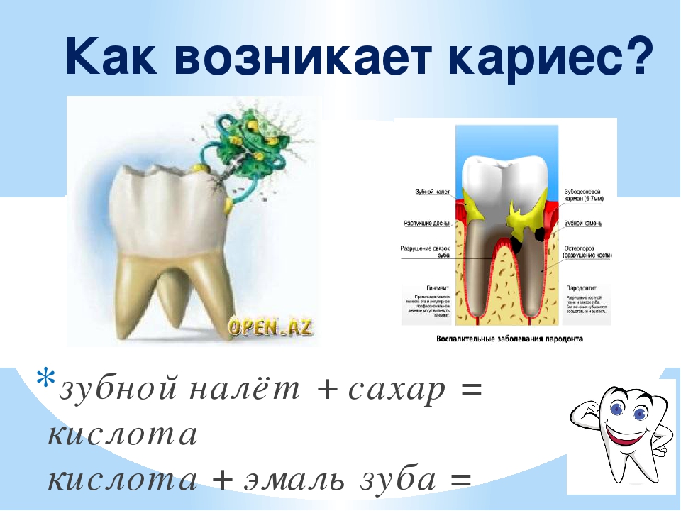 Заболевания зубов и полости. Karess. Кариес причины возникновения. Начальная степень кариеса.