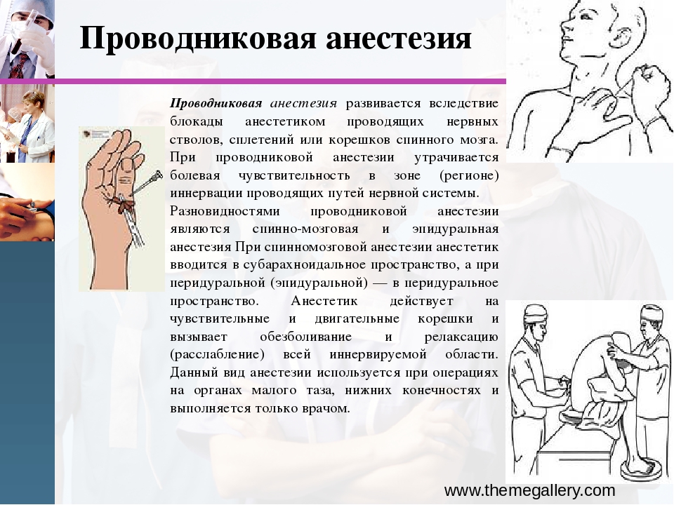 Проведение проводниковой анестезии. Провод ковая анестезия. Проводниковаяанастезия. Методика проведения проводниковой анестезии. Проводниковая анестезия в анестезиологии.