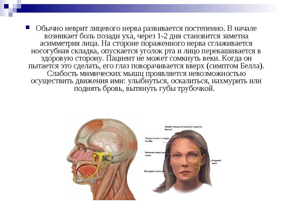 Лечения лицевой невропатия. Клинические проявления при неврите лицевого нерва. При неврите лицевого нерва страдают мышцы :. Неврит лицевого нерва тактика фельдшера. Основной синдром при неврите лицевого нерва:.