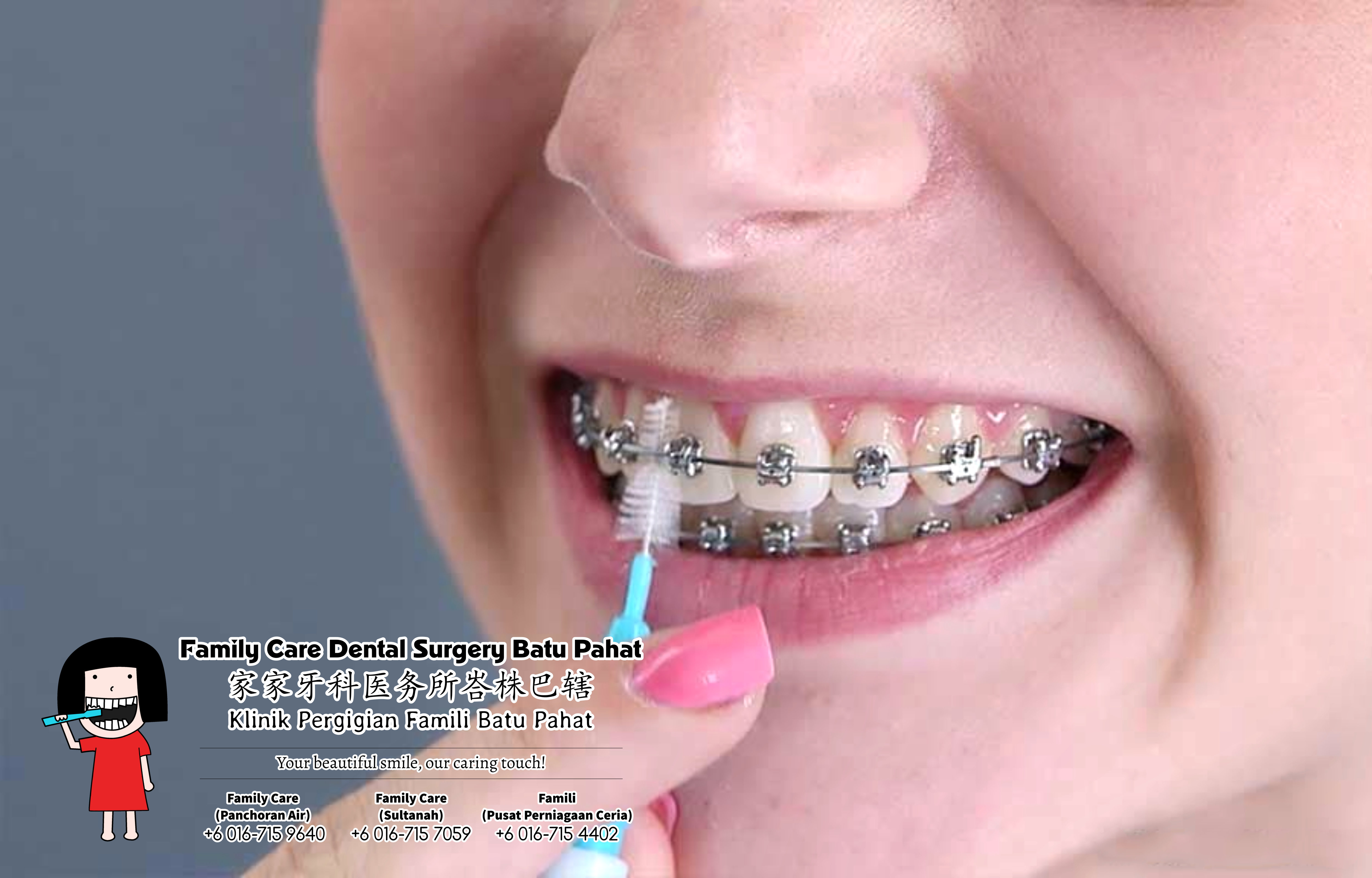 Брекеты на зубы для детей сколько стоят